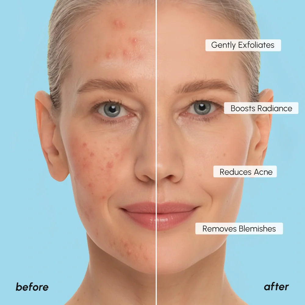 Glycolic Acid Pads 200 PCS