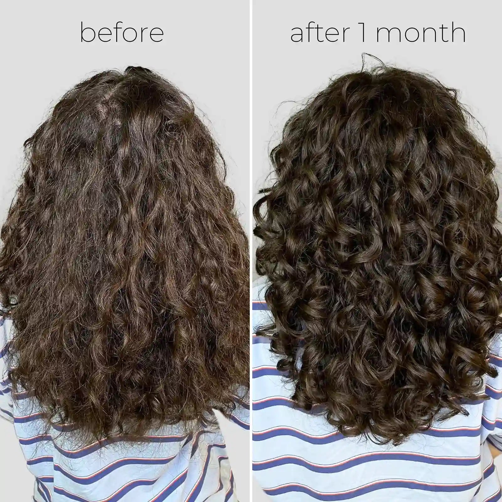 Oil Capsules For Frizzy Hair
